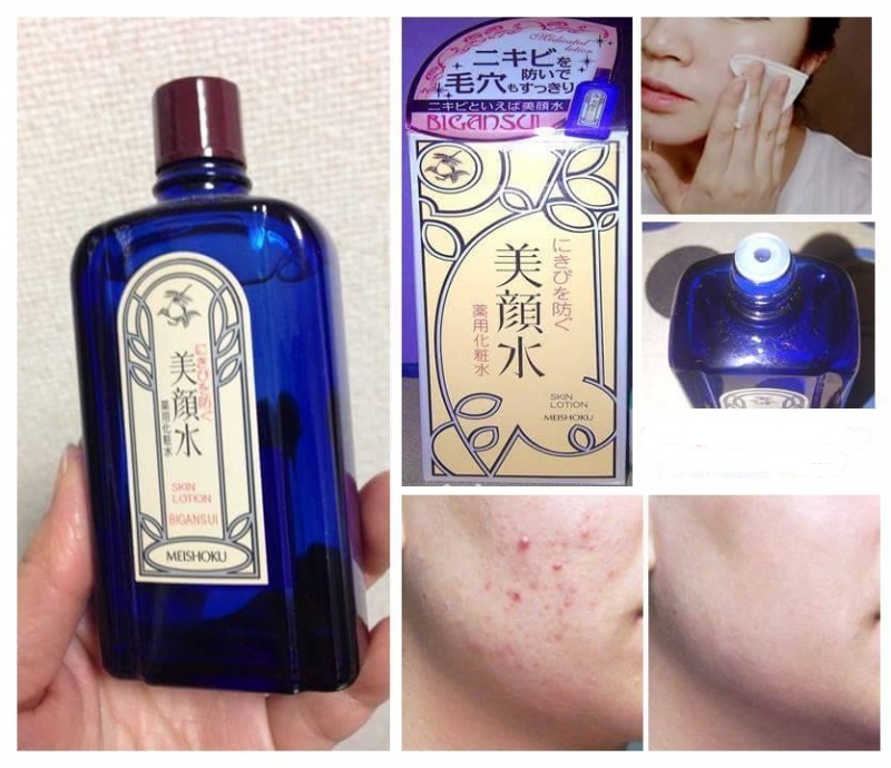 Nước Hoa Hồng Đặc Trị Mụn Meishoku Bigan Medicated Skin Lotion 80ml
